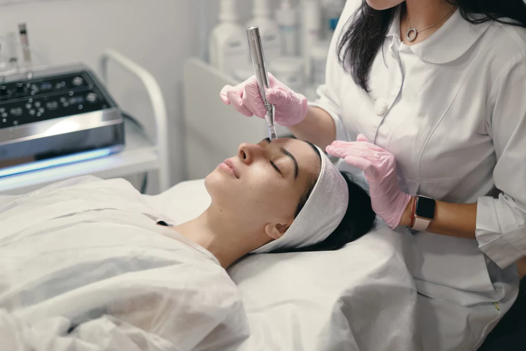 Micro needling Treatment in Vancouver/ Burnaby
