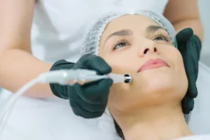 Facial Rejuvenation Treatment in Vancouver/ Burnaby