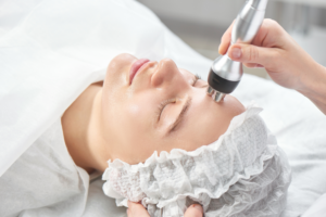 Radiofrequency Skincare Treatments