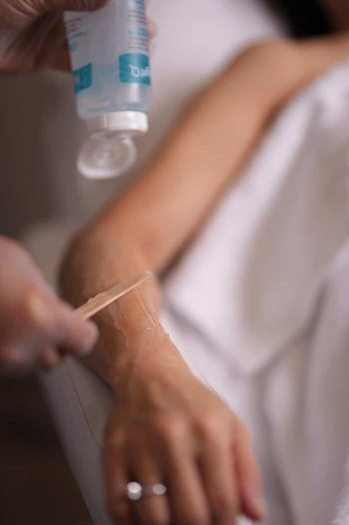 hair removal vancouver